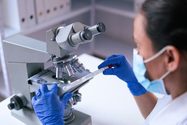 <p>Badacz laboratoryjny badający próbki mikrobiologiczne pod mikroskopem medycznym</p>